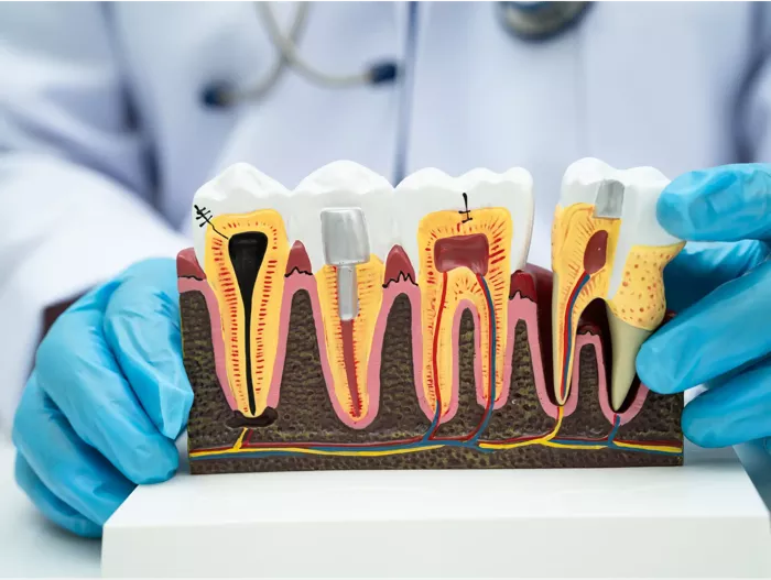 Endodonzia Studio Dentistico Azzini Trento