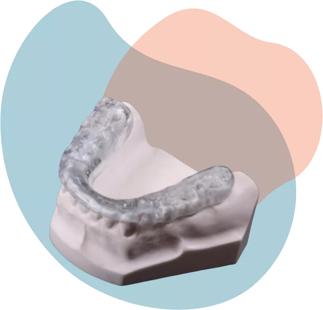 Bite dentale Studio Dentistico Azzini Trento